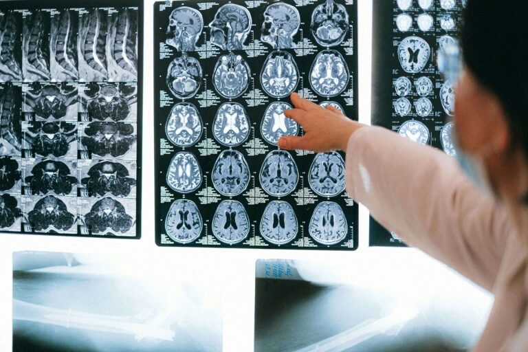 AI-Related Brain Health Disorders: Causes and How to Fight Back